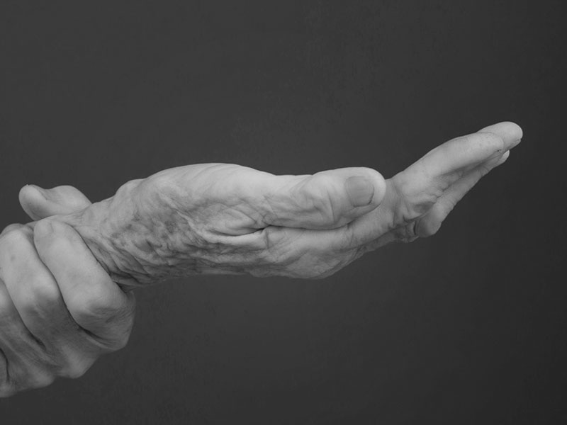 L’origine del “diritto di morire”: siamo spaventati